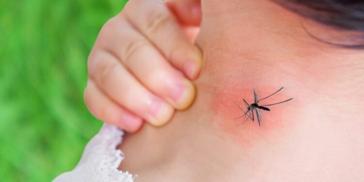 डेंगुका अधिकांश बिरामीमा घाँटीमा घाउ हुने समस्या