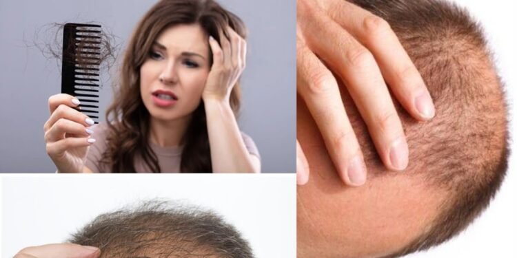 कपाल झर्ने समस्या छ ? यसरी गर्नुस् रोकथाम