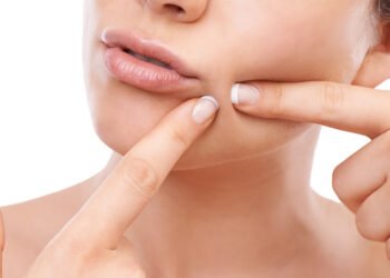 डण्डिफोरले हैरान हुनुहुन्छ ? यस्ता खानेकुरामा ध्यान दिनुस्