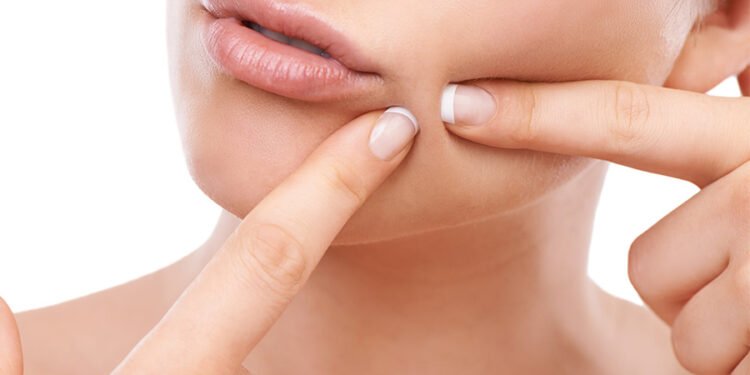 डण्डिफोरले हैरान हुनुहुन्छ ? यस्ता खानेकुरामा ध्यान दिनुस्