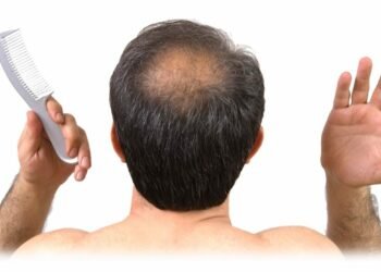 यस्तो छ तालु खुइले रोगको घरेलु उपचार