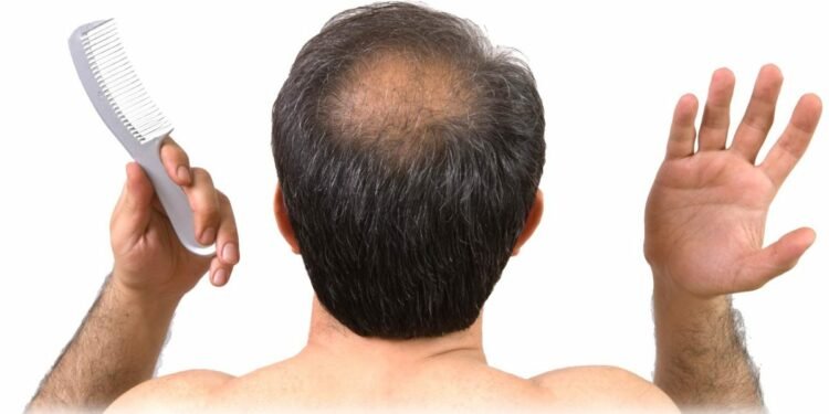 यस्तो छ तालु खुइले रोगको घरेलु उपचार