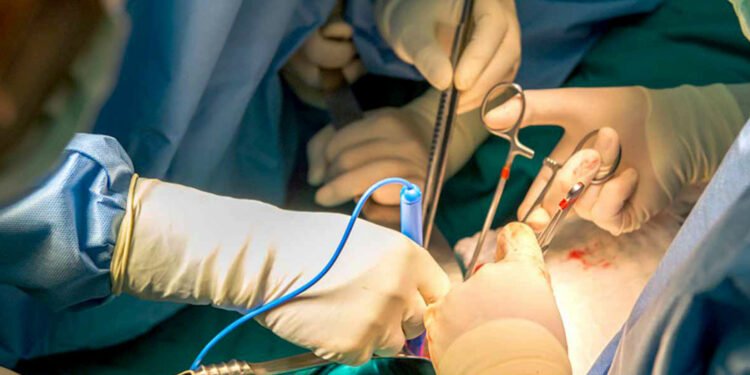 कर्णालीमा पहिलो पटक मिर्गौला प्रत्यारोपण सम्पन्न