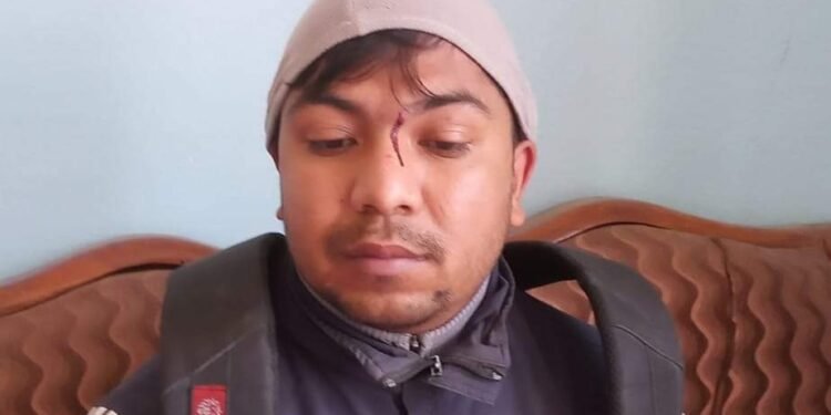 वडाध्यक्ष गुरुङले गरे इन्जिनियरमाथि हातपात