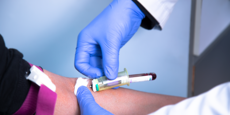 बुटवलमा रगतसम्बन्धी सबै सेवा निःशुल्क