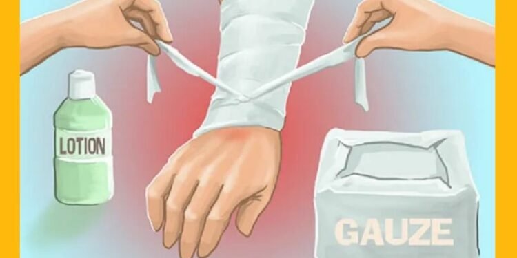 हेल्थ टिप्सः तातो झोलले पोलेमा कसरी डाहा कम गर्ने ?