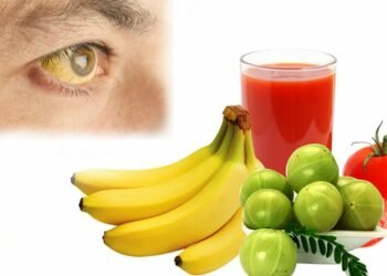 हेल्थ टिप्सः कमलपित्त रोगको घरेलु उपचार विधि