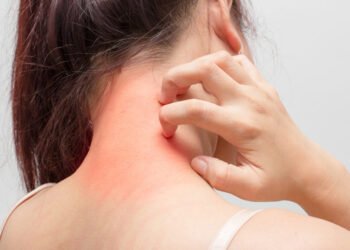 हेल्थ टिप्सः लुतो आएमा के गर्ने ?