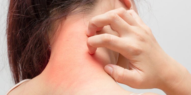 हेल्थ टिप्सः लुतो आएमा के गर्ने ?