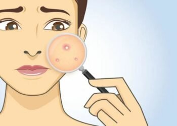 हेल्थ टिप्सः खटिरो पिलो निस्कँदा चाँडै पकाउनु परेमा के गर्ने ?