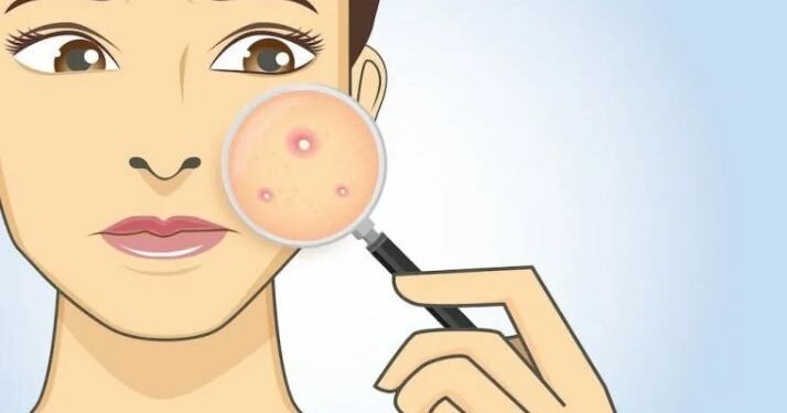 हेल्थ टिप्सः खटिरो पिलो निस्कँदा चाँडै पकाउनु परेमा के गर्ने ?