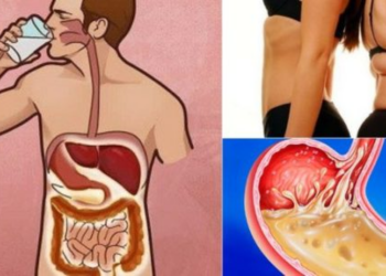 हेल्थ टिप्सः रगतमासी परेमा के गर्ने ?