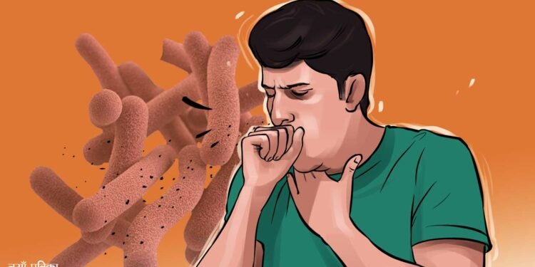 हेल्थ टिप्सः क्षयरोगको रोकथाम तथा घरेलु उपचार