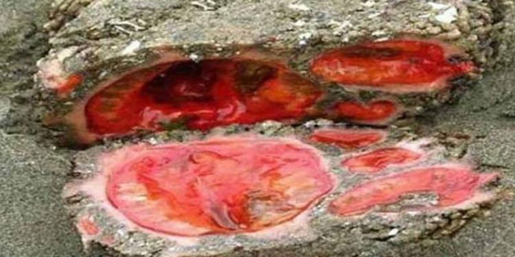 रोचक प्रसङ्गः काटेपछि रगत आउने ढुङ्गा !