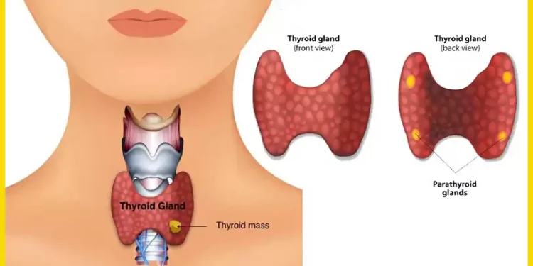थाइराइड के हो, कस्ता हुन्छन् लक्षण ?