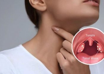 हेल्थ टिप्सः टन्सिल छिट्टै निको पार्ने घरायसी उपचार