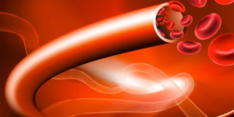 हेल्थ टिप्सः रगतमा भएको फोहोरलाई कसरी हटाउने त ?