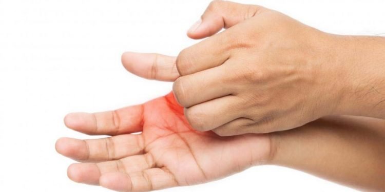 हेल्थ टिप्सः हत्केला चिलाउनुको रहस्य