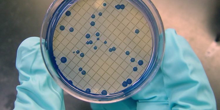 खानेपानीमा अत्यधिक ‘कोलीफर्म’ भेटियो