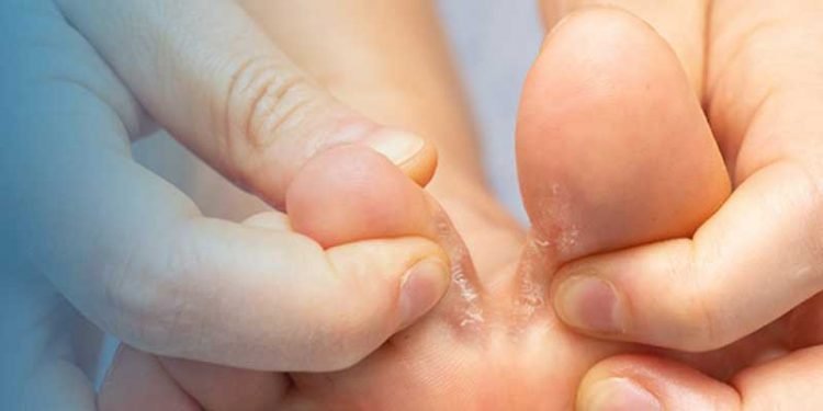 हिलोले खाएको घरेलु उपचार विधी