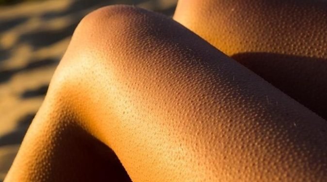 शरीरमा काँडा उम्रिनुको कारण के हो ?