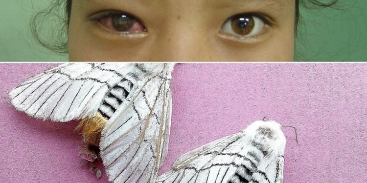 सापू रोगबाट बच्न चिकित्सकको आग्रह