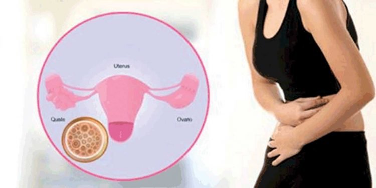 महिलाले पाठेघर खस्नबाट जोगिन के गर्ने