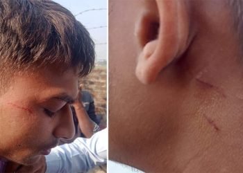 ज्याकेट लगाएको भन्दै प्रिन्सिपलुद्वारा विद्यार्थीमाथि कुटपिट