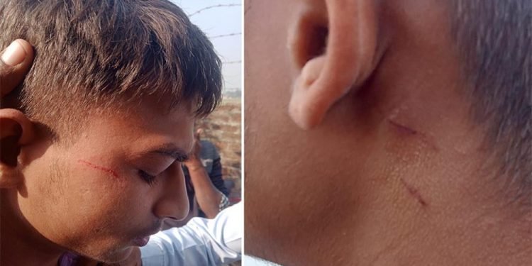 ज्याकेट लगाएको भन्दै प्रिन्सिपलुद्वारा विद्यार्थीमाथि कुटपिट