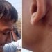 ज्याकेट लगाएको भन्दै प्रिन्सिपलुद्वारा विद्यार्थीमाथि कुटपिट