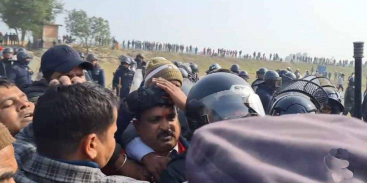 प्रहरीको लाठीचार्जबाट मधेसका शिक्षामन्त्रीको टाउको फुट्यो