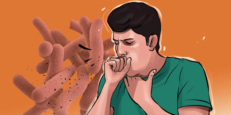 ४५ प्रतिशत क्षयरोगका बिरामी उपचारभन्दा बाहिर