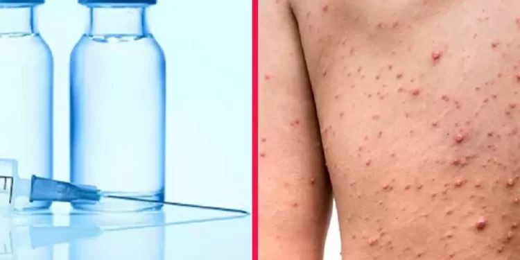 कालीकोटमा १७ हजार बालबालिकालाई दादुरा-रुबेलाविरुद्धको खोप