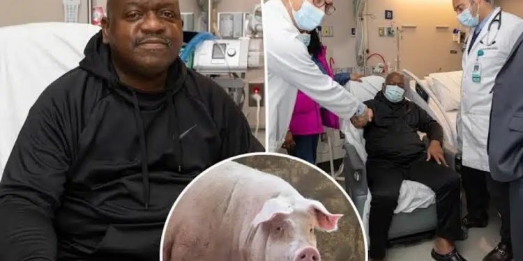 जीन सम्पादित सुँगुरको मिर्गौला प्रत्यारोपण गर्ने पहिलो बिरामीको निधन