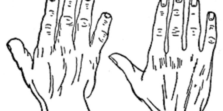 प्रारम्भिक हात हुनेहरुको जीवन कस्तो हुन्छ ?