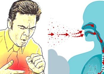 क्षयरोगको रोकथाम तथा घरेलु उपचार
