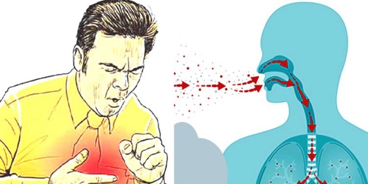 क्षयरोगको रोकथाम तथा घरेलु उपचार