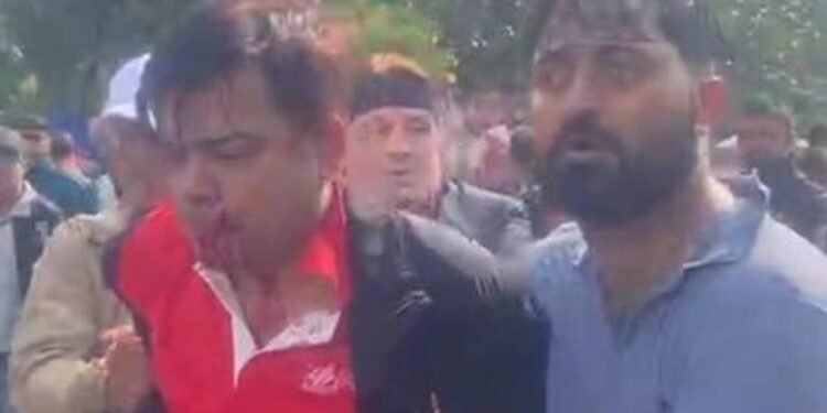 घुसपैठियाको आरोपमा पोखरामा रास्वपाका नेता कुटिए