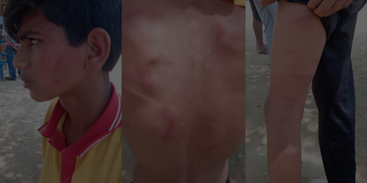 मरणाशन्न कुट्ने शिक्षक पक्राउ, १३ वर्षीय विद्यार्थी अस्पताल भर्ना