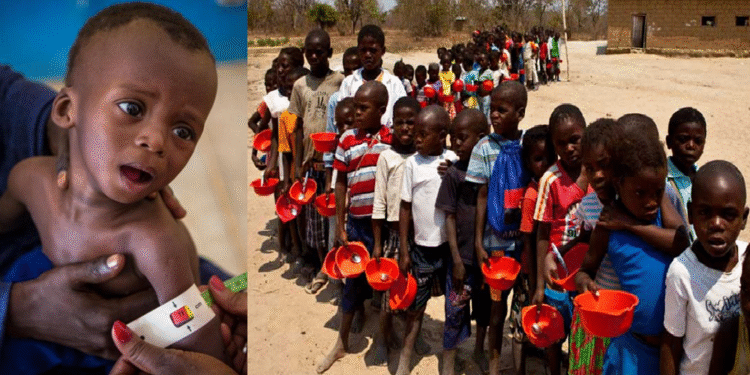 अक्टोबर २०२३ देखि कुपोषणबाट ५७ जना गाजावासीको मृत्यु