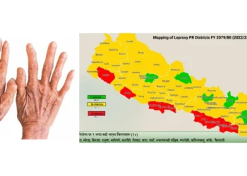 नेपालमा सबैभन्दा बढी नयाँ कुष्ठरोगका बिरामीहरु मधेस प्रदेशमा