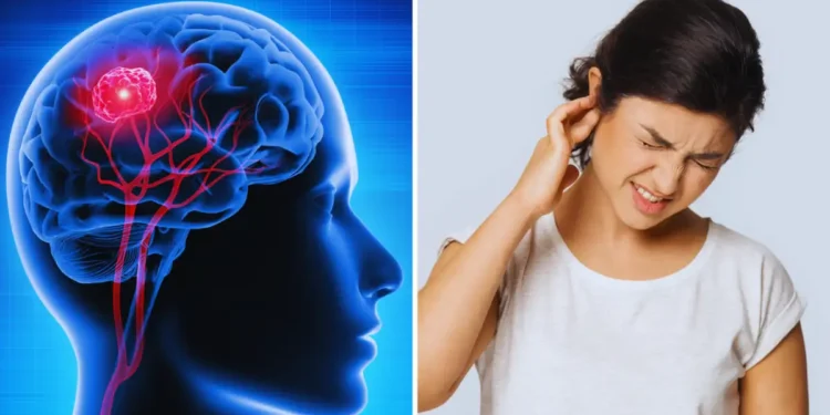 बालबालिका र वयस्कहरूमा ब्रेन ट्युमरको जोखिम बढ्दै