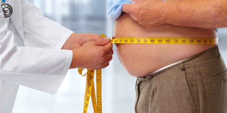 मोटोपन अब सामान्य समस्या होइन, अनुसन्धानले देखायो गम्भीर संकेत