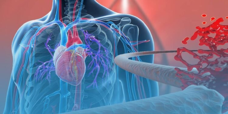 सुई नपाउँदा छटपटिन्छन्, ‘हेमोफिलिया’का बिरामी