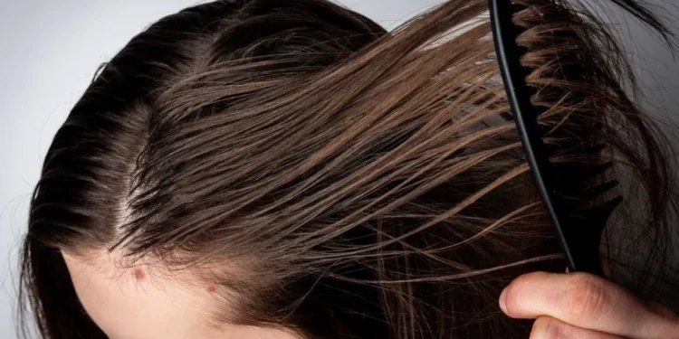 मनसुनमा टाउकोको तेलयुक्त भागबाट छुटकारा पाउन यी सजिला उपायहरू अपनाउनुहोस्