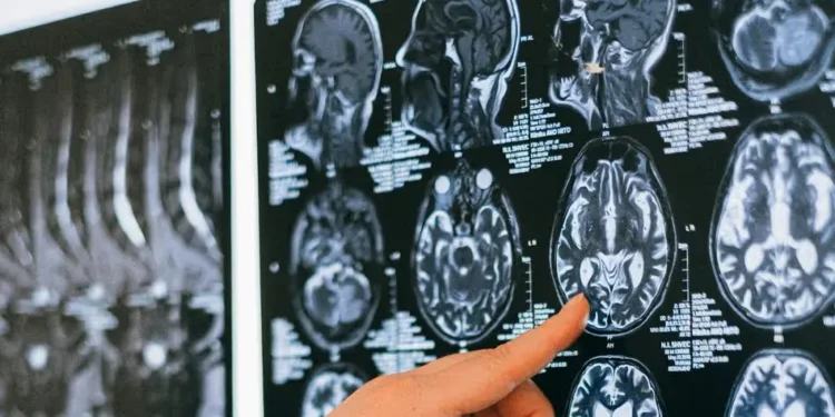 रूसी वैज्ञानिकद्वारा ग्लियोब्लास्टोमा उपचारका लागि अभिनव उपकरण विकास