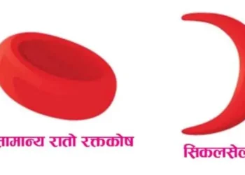 सिकलसेलका रोगीलाई पोषणयुक्त खानपान आवश्यक