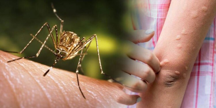 चितवनका तीन जनामा जापानिज इन्सेफलाइटिस