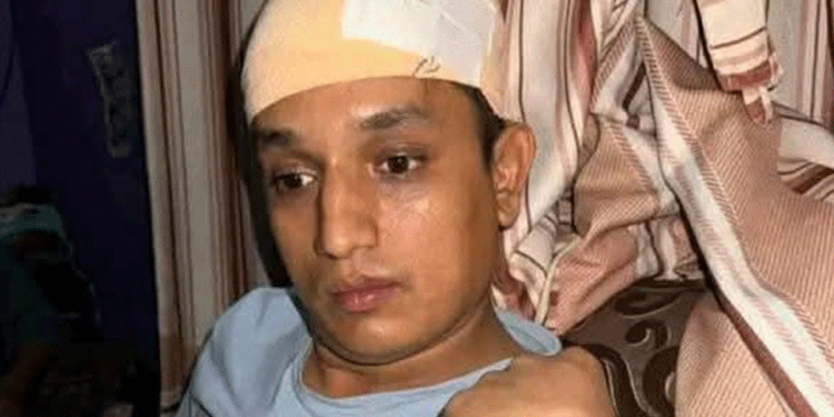 रास्वपा नेता बदन भण्डारीमाथि काठमाडौंमा आक्रमण