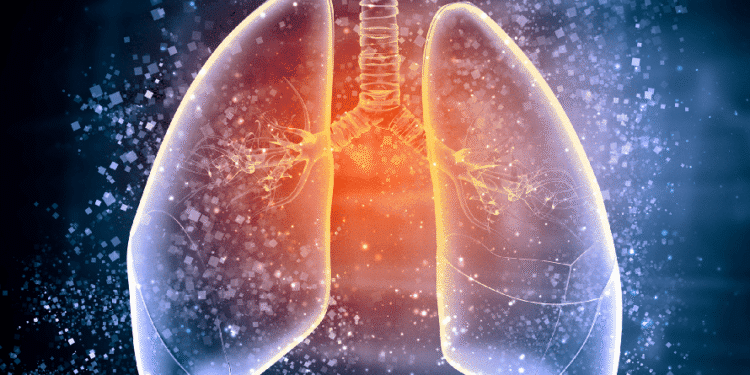 बर्दिबासमा क्षयरोगी बढे